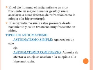 El astigmatismo | PPT