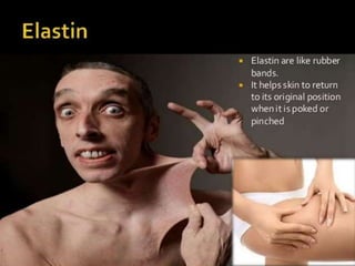 Elastin