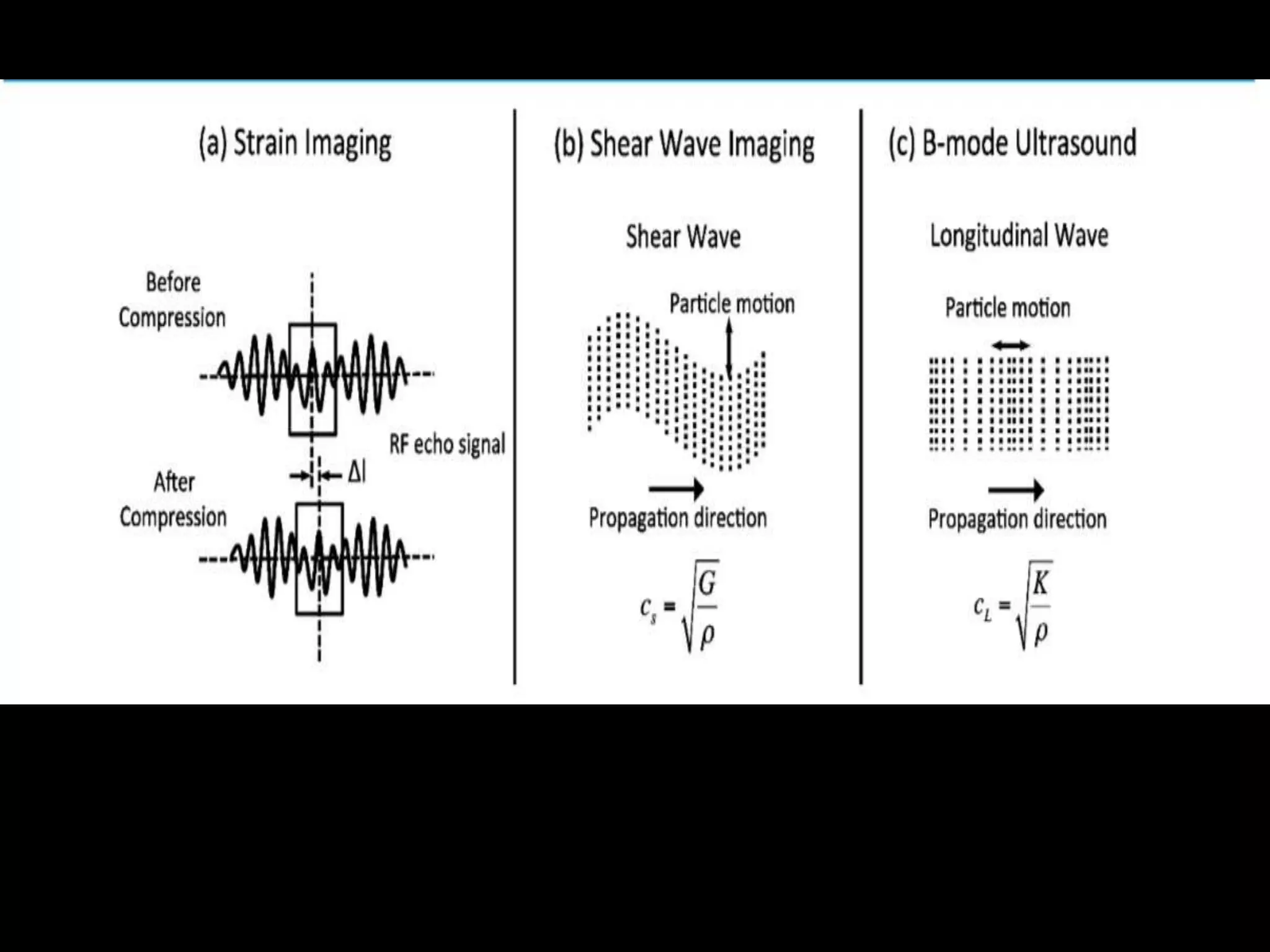 Shear wave Elastography of Liver | PPTX