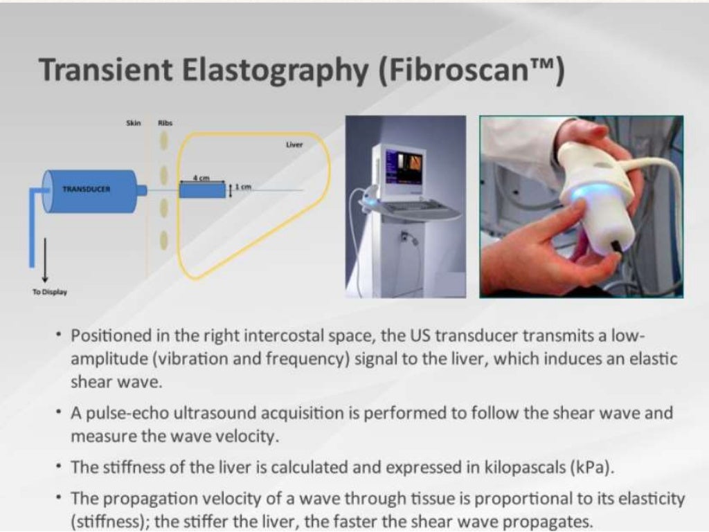 Shear wave Elastography of Liver