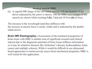 Skeletal muscle MRE
(a) A sagittal MR image of the calf soleus muscle with the location of the
driver indicated by the arrow is shown. 100-Hz MRE wave images of the
muscle are shown while exerting 0 (b), 5 (c) and 10 N/m (d) of force.
The increase in the wavelength (and thus stiffness) with
the increase in muscle force is easily visible and is indicated by the double
sided arrows.
Brain MR Elastography—Assessment of the mechanical properties of
brain tissue with MRE is another area of significant research and clinical
interest due to the diagnostic potential of brain tissue stiffness information
as it may be related to diseases like Alzheimer’s disease, hydrocephalus, brain
cancer and multiple sclerosis. While it would be difficult to use ultrasound
based approaches to noninvasively assess brain mechanical properties, MRE is
well suited for this application.
 