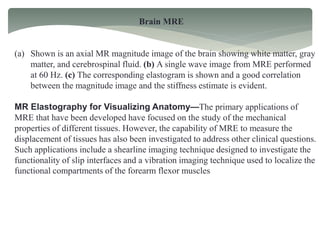 Brain MRE
(a) Shown is an axial MR magnitude image of the brain showing white matter, gray
matter, and cerebrospinal fluid. (b) A single wave image from MRE performed
at 60 Hz. (c) The corresponding elastogram is shown and a good correlation
between the magnitude image and the stiffness estimate is evident.
MR Elastography for Visualizing Anatomy—The primary applications of
MRE that have been developed have focused on the study of the mechanical
properties of different tissues. However, the capability of MRE to measure the
displacement of tissues has also been investigated to address other clinical questions.
Such applications include a shearline imaging technique designed to investigate the
functionality of slip interfaces and a vibration imaging technique used to localize the
functional compartments of the forearm flexor muscles
 