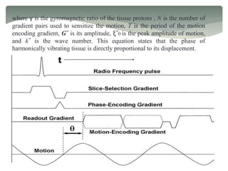 where γ is the gyromagnetic ratio of the tissue protons , N is the number of
gradient pairs used to sensitize the motion, T is the period of the motion
encoding gradient, G⃗ is its amplitude, ξ⃗0 is the peak amplitude of motion,
and k⃗ is the wave number. This equation states that the phase of
harmonically vibrating tissue is directly proportional to its displacement.
 