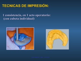 TECNICAS DE IMPRESIÓN: 1 consistencia, en 1 acto operatorio: (con cubeta individual) 