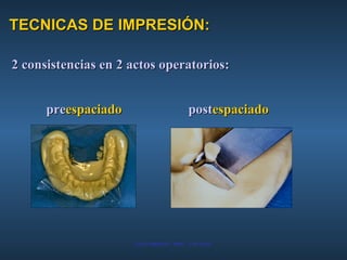 TECNICAS DE IMPRESIÓN: 2 consistencias en 2 actos operatorios: pre espaciado    post espaciado 
