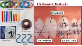 Elastomeric ligatures
 