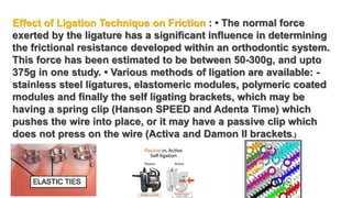 Effect of Ligation Technique on Friction : • The normal force
exerted by the ligature has a significant influence in determining
the frictional resistance developed within an orthodontic system.
This force has been estimated to be between 50-300g, and upto
375g in one study. • Various methods of ligation are available: -
stainless steel ligatures, elastomeric modules, polymeric coated
modules and finally the self ligating brackets, which may be
having a spring clip (Hanson SPEED and Adenta Time) which
pushes the wire into place, or it may have a passive clip which
does not press on the wire (Activa and Damon II brackets.)
 