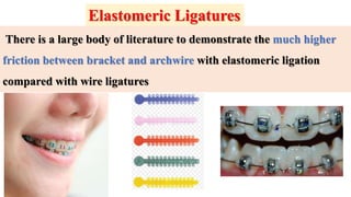 There is a large body of literature to demonstrate the much higher
friction between bracket and archwire with elastomeric ligation
compared with wire ligatures
Elastomeric Ligatures
 