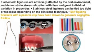 Elastomeric ligatures are adversely affected by the oral environment,
and demonstrate stress relaxation with time and great individual
variation in properties. • Stainless steel ligatures can be tied too tight
or too loose depending on the clinicians technique. • Self ligating
brackets with a passive clip have been shown to generate negligible
friction
 