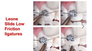 Leone
Slide Low
Friction
ligatures
 