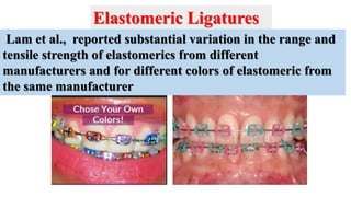 Lam et al., reported substantial variation in the range and
tensile strength of elastomerics from different
manufacturers and for different colors of elastomeric from
the same manufacturer
Elastomeric Ligatures
 