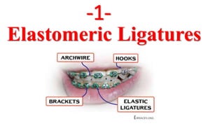 Elastomeric Ligatures
-1-
 