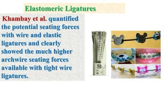 Khambay et al. quantified
the potential seating forces
with wire and elastic
ligatures and clearly
showed the much higher
archwire seating forces
available with tight wire
ligatures.
Elastomeric Ligatures
 