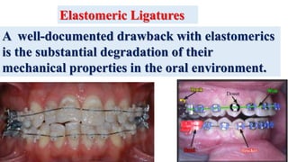 A well-documented drawback with elastomerics
is the substantial degradation of their
mechanical properties in the oral environment.
Elastomeric Ligatures
 