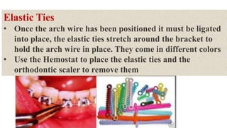 Elastic Ties
• Once the arch wire has been positioned it must be ligated
into place, the elastic ties stretch around the bracket to
hold the arch wire in place. They come in different colors
• Use the Hemostat to place the elastic ties and the
orthodontic scaler to remove them
 