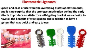 Speed and ease of use were the overriding assets of elastomerics,
and it is no surprise that the strongest motivation behind the early
efforts to produce a satisfactory self-ligating bracket was a desire to
have all the benefits of wire ligation but in addition to have a
system that was quick and easy to use.
Elastomeric Ligatures
 