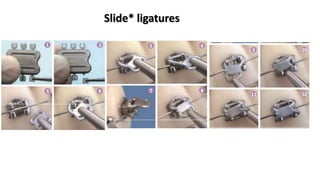 Slide* ligatures
 