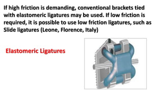 If high friction is demanding, conventional brackets tied
with elastomeric ligatures may be used. If low friction is
required, it is possible to use low friction ligatures, such as
Slide ligatures (Leone, Florence, Italy)
Elastomeric Ligatures
 