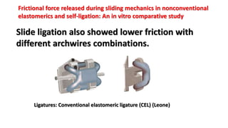 Ligatures: Conventional elastomeric ligature (CEL) (Leone)
Slide ligation also showed lower friction with
different archwires combinations.
Frictional force released during sliding mechanics in nonconventional
elastomerics and self-ligation: An in vitro comparative study
 