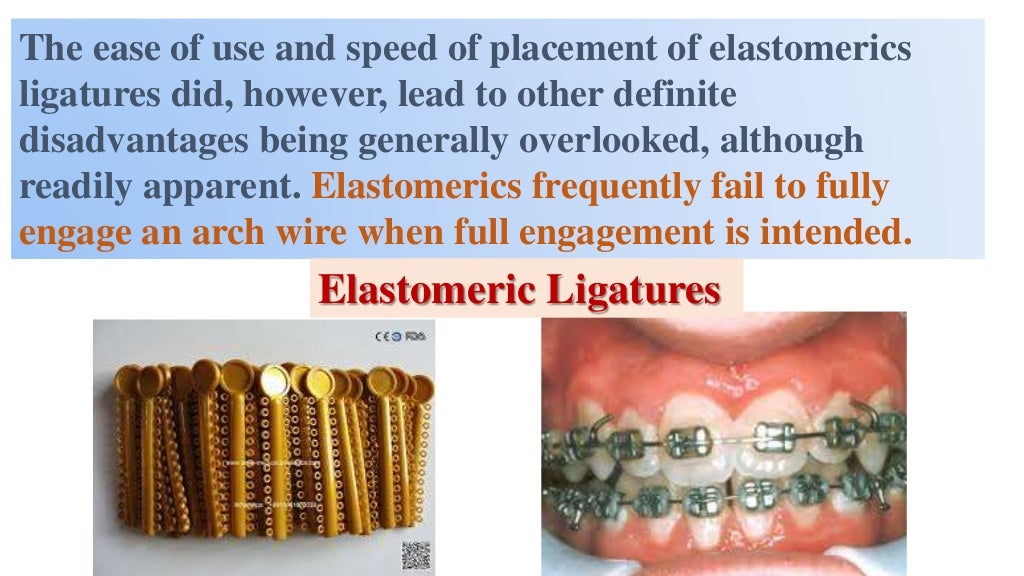 Elastomeric ligatures final. Prof. maher fouda
