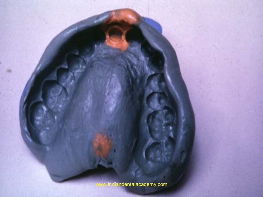 Elastomers/ dentistry technology