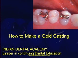 How to Make a Gold Casting
INDIAN DENTAL ACADEMY
Leader in continuing Dental Educationwww.indiandentalacademy.com
 