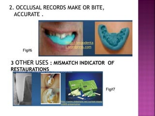 2. OCCLUSAL RECORDS MAKE OR BITE,
  ACCURATE .



                     http://expodenta
                     l.wordpress.com
    Fig#6


3 OTHER USES : MISMATCH INDICATOR OF
RESTAURATIONS


                                                            Fig#7


                 http://www.slideshare.net/yuritek/elasto
                 m2005-presentation
 