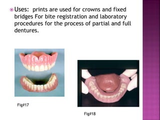  Uses: prints are used for crowns and fixed
 bridges For bite registration and laboratory
 procedures for the process of partial and full
 dentures.




  Fig#17

                            Fig#18
 