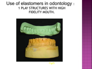 Use of elastomers in odontology :
     1 PLAY STRUCTURES WITH HIGH
            FIDELITY MOUTH.




                      Fig#5
 
