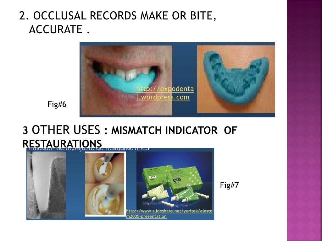 Elastomers for dental uses