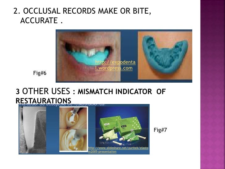 Elastomers for dental uses