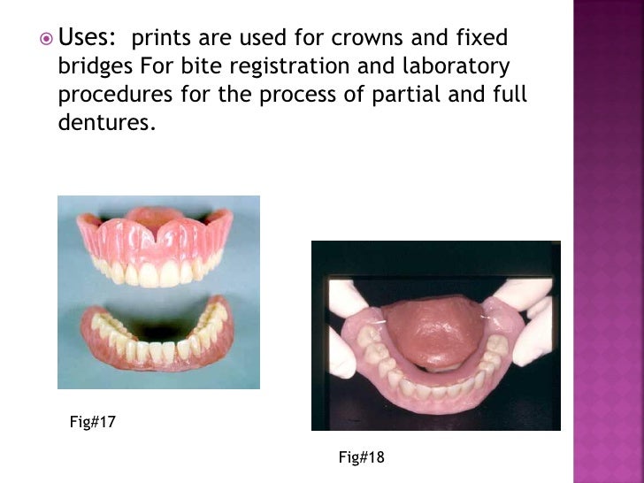 Elastomers for dental uses