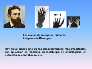 Las manos de su esposa, primeras
imágenes de Rôentgen.
Hoy sigue siendo uno de los descubrimientos más importantes,
con aplicación en medicina, en metalurgia, en cristalografía, en
detección de contrabando, etc.
 