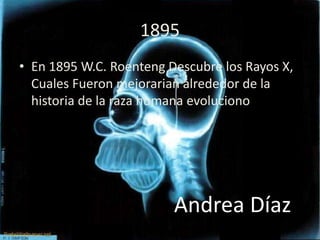 1895
• En 1895 W.C. Roenteng Descubre los Rayos X,
  Cuales Fueron mejorarian alrededor de la
  historia de la raza humana evoluciono los
  rayos X.




                         Andrea Díaz
 