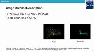 Vision-Based Approach for Autism Diagnosis Using Transfer Learning and ...