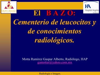El B A Z O:
Cementerio de leucocitos y
   de conocimientos
     radiológicos.

  Motta Ramírez Gaspar Alberto, Radiólogo, HAP
           gamottar@yahoo.com.mx


             Radiología e Imagen.
 