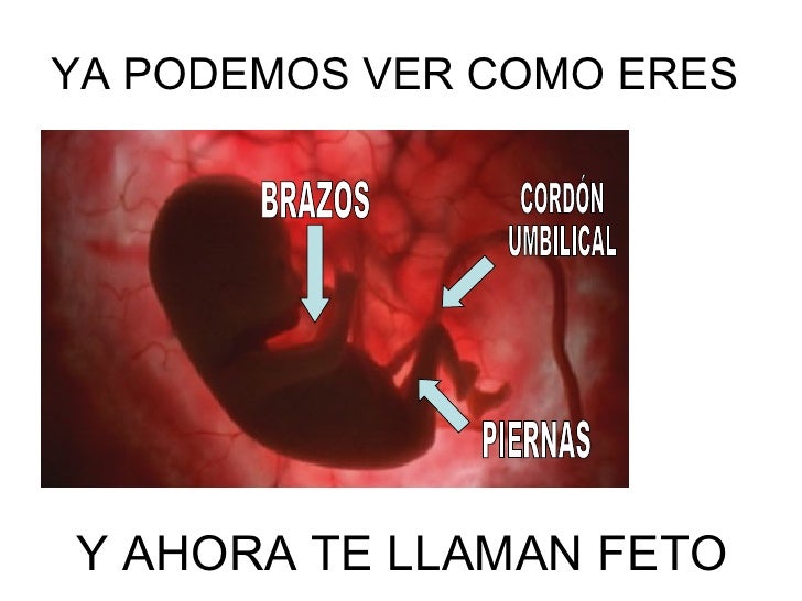 El Bebe El Bebe