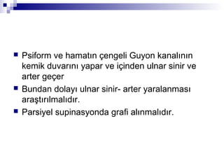   Psiform ve hamatın çengeli Guyon kanalının
    kemik duvarını yapar ve içinden ulnar sinir ve
    arter geçer
   Bundan dolayı ulnar sinir- arter yaralanması
    araştırılmalıdır.
   Parsiyel supinasyonda grafi alınmalıdır.
 