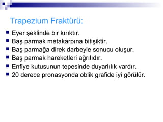 Trapezium Fraktürü:
   Eyer şeklinde bir kırıktır.
   Baş parmak metakarpına bitişiktir.
   Baş parmağa direk darbeyle sonucu oluşur.
   Baş parmak hareketleri ağrılıdır.
   Enfiye kutusunun tepesinde duyarlılık vardır.
   20 derece pronasyonda oblik grafide iyi görülür.
 