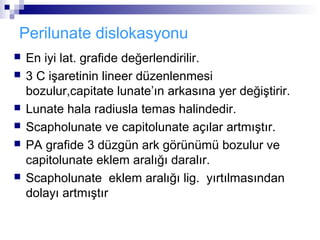 Perilunate dislokasyonu
   En iyi lat. grafide değerlendirilir.
   3 C işaretinin lineer düzenlenmesi
    bozulur,capitate lunate’ın arkasına yer değiştirir.
   Lunate hala radiusla temas halindedir.
   Scapholunate ve capitolunate açılar artmıştır.
   PA grafide 3 düzgün ark görünümü bozulur ve
    capitolunate eklem aralığı daralır.
   Scapholunate eklem aralığı lig. yırtılmasından
    dolayı artmıştır
 