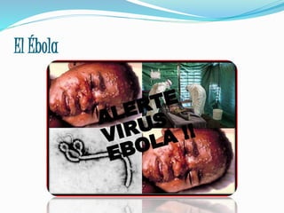 El Ébola
 
