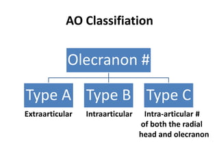 AO Classifiation
Extraarticular Intraarticular Intra-articular #
of both the radial
head and olecranon
Olecranon #
Type A Type B Type C
 