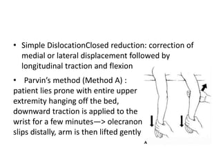 • Simple DislocationClosed reduction: correction of
medial or lateral displacement followed by
longitudinal traction and flexion
• Parvin’s method (Method A) :
patient lies prone with entire upper
extremity hanging off the bed,
downward traction is applied to the
wrist for a few minutes—> olecranon
slips distally, arm is then lifted gently
 