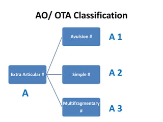 AO/ OTA Classification
Extra Articular #
Avulsion #
Simple #
Multifragmentary
#
A 1
A 2
A 3
A
 