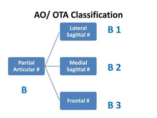 AO/ OTA Classification
Partial
Articular #
Lateral
Sagittal #
Medial
Sagittal #
Frontal #
B 1
B 2
B 3
B
 