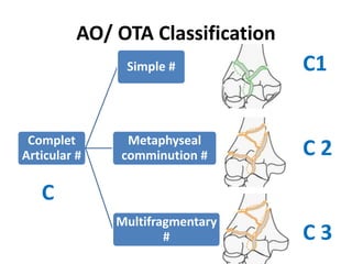 AO/ OTA Classification
Complet
Articular #
Simple #
Metaphyseal
comminution #
Multifragmentary
#
C1
C 2
C 3
C
 