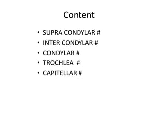 Content
• SUPRA CONDYLAR #
• INTER CONDYLAR #
• CONDYLAR #
• TROCHLEA #
• CAPITELLAR #
 