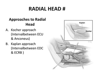 RADIAL HEAD #
Approaches to Radial
Head
A. Kocher approach
(Intervalbetween ECU
& Anconeus)
B. Kaplan approach
(Intervalbetween EDC
& ECRB )
 