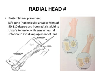 RADIAL HEAD #
• Posterolateral placement
Safe zone (nonarticular area) consists of
90-110 degree arc from radial styloid to
Lister's tubercle, with arm in neutral
rotation to avoid impingement of ulna
with forearm rotation.
 