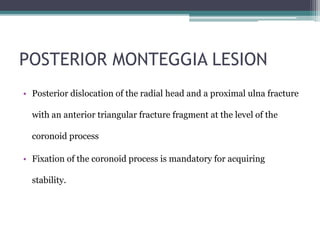 POSTERIOR MONTEGGIA LESION
• Posterior dislocation of the radial head and a proximal ulna fracture
with an anterior triangular fracture fragment at the level of the
coronoid process
• Fixation of the coronoid process is mandatory for acquiring
stability.
 
